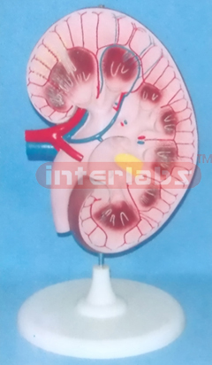 SUPER KIDNEY ANATOMICAL ENLARGED MODEL